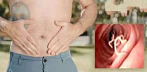 Quick Relief Stomach Worm Home Remedies ( पेट के कीड़े का सफल घरेलू उपचार )