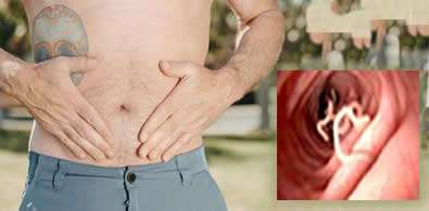 Quick Relief Stomach Worm Home Remedies ( पेट के कीड़े का सफल घरेलू उपचार )